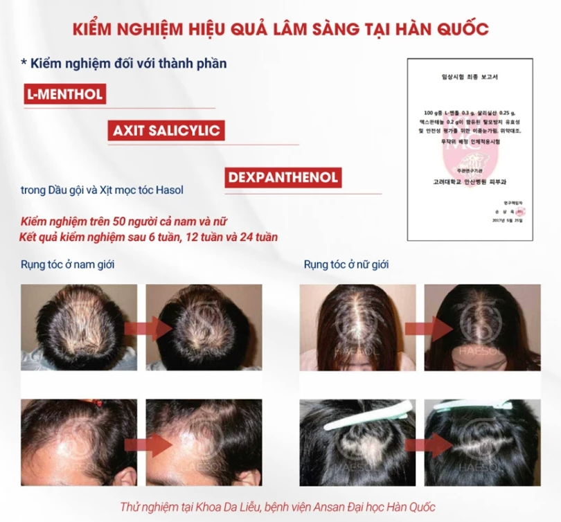 Hasol Anagen Active Tonic 100ml Hair Growth Spray Nourishes Scalp, Nourishes Hair Follicles